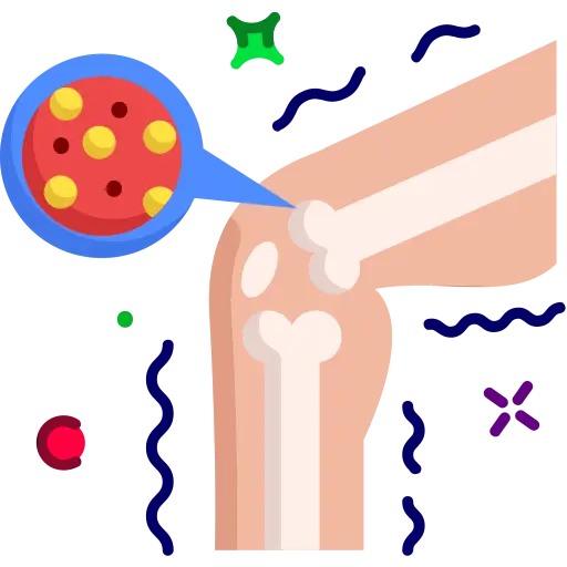 bone cancer.png