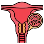 cervical cancer.png